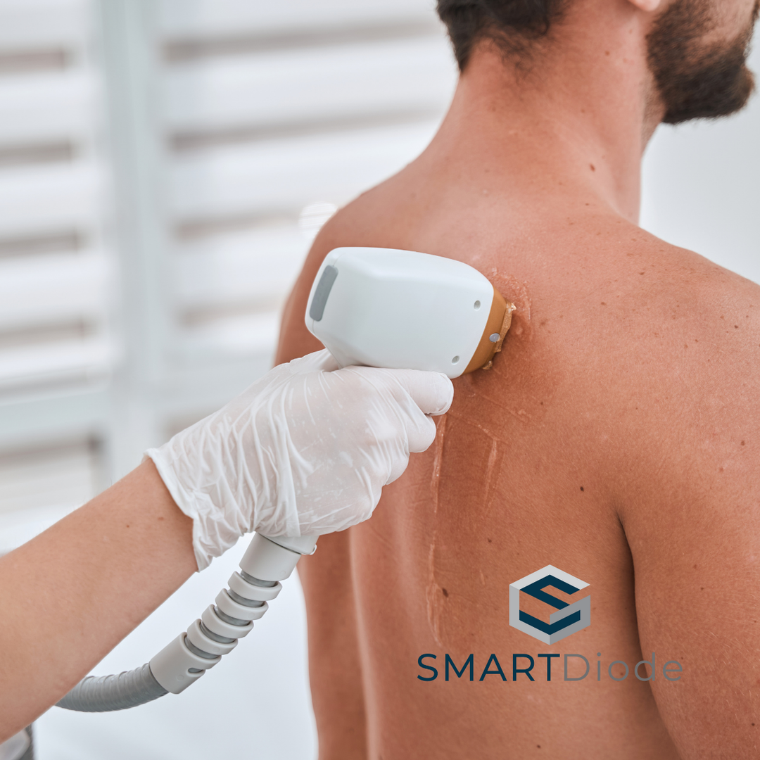 Back Laser Hair Removal | PURE Spa UK