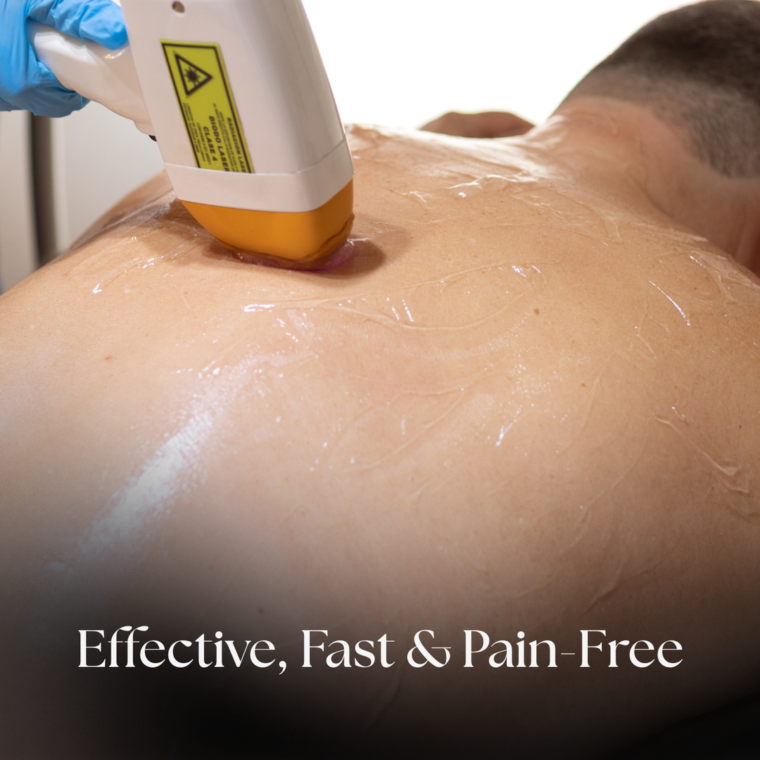 Back Laser Hair Removal | PURE Spa UK