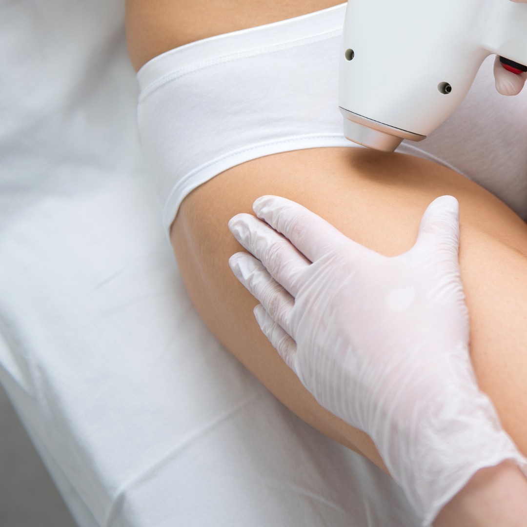 Bikini Line Laser Hair Removal