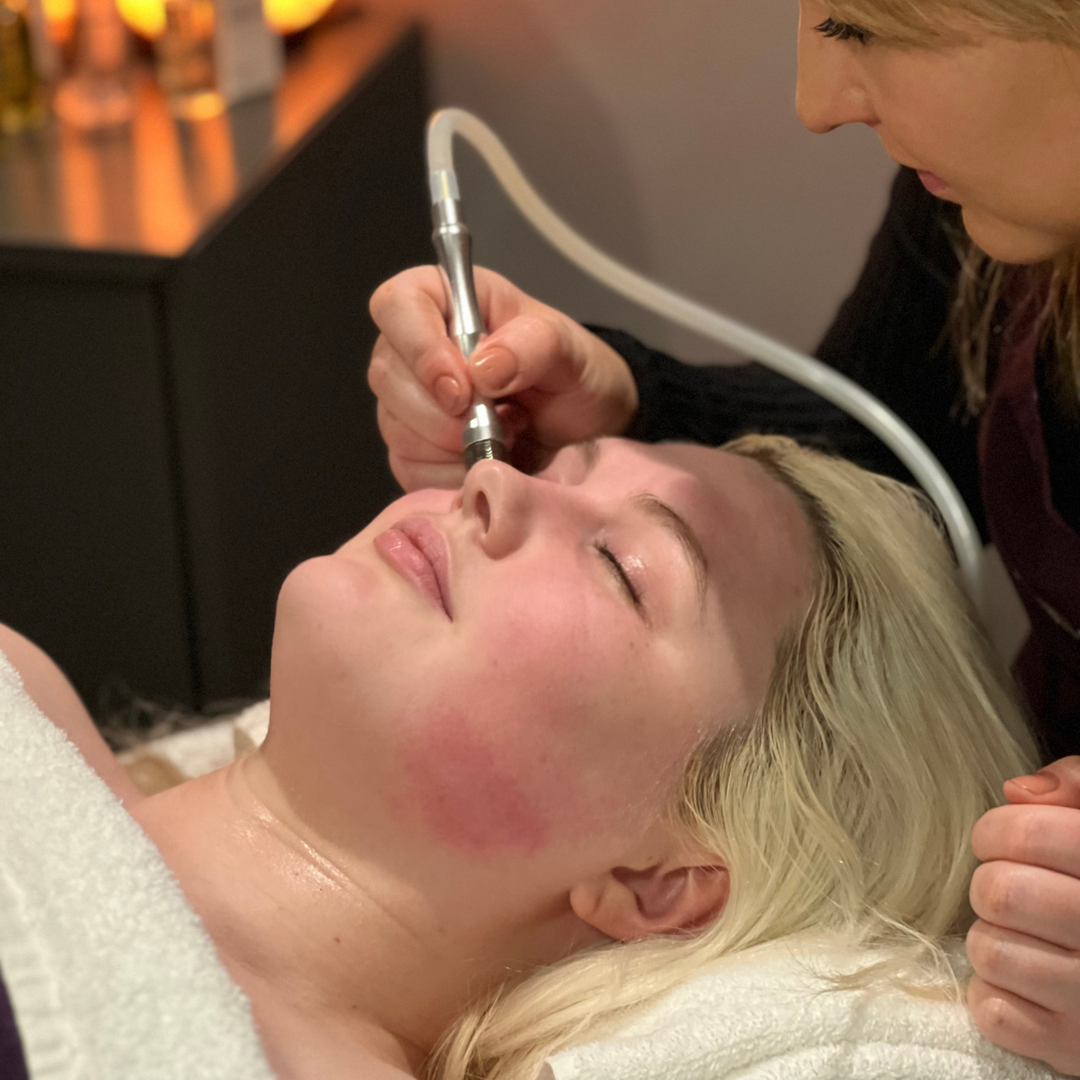 Diamond Peel Facial + LED Therapy 120 Min Treatment | PURE Spa UK