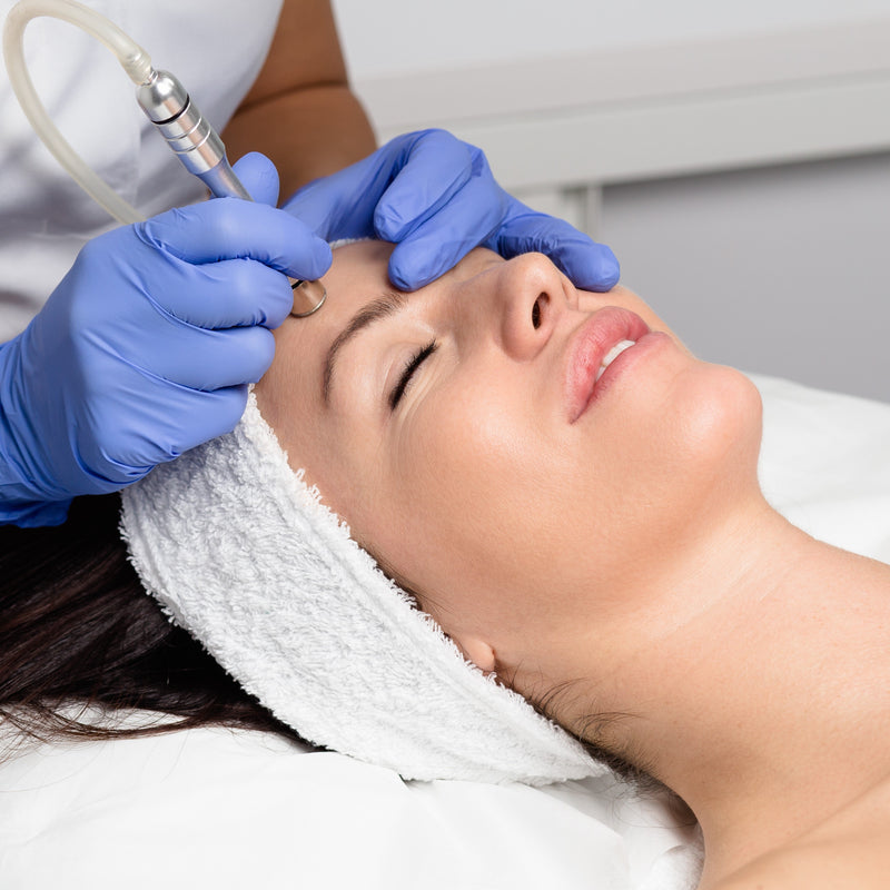 Course Offer - PURE Diamond Peel Facial (30 min) - 6 for 4