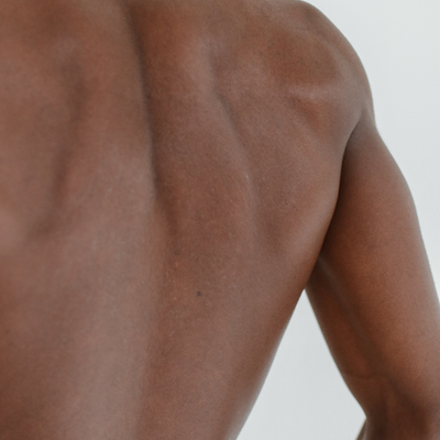 Back Laser Hair Removal