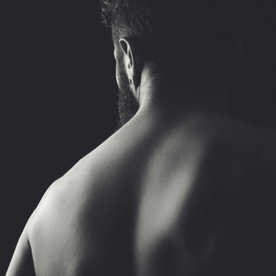 Back Laser Hair Removal