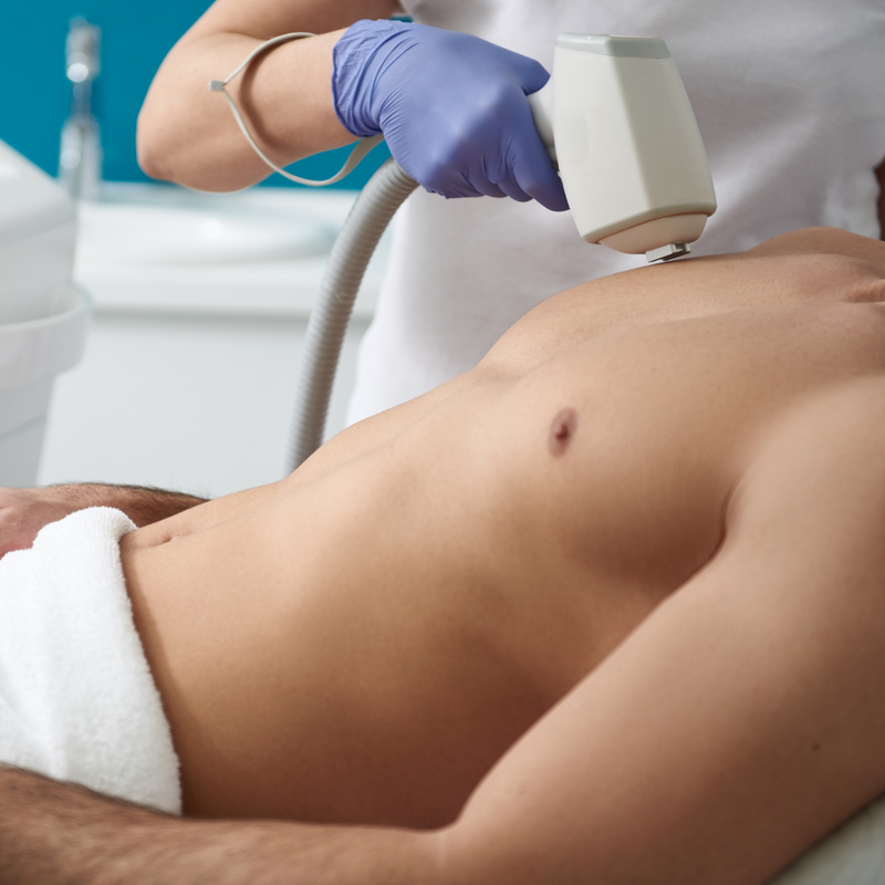 Chest & Abs Laser Hair Removal