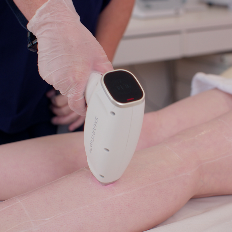 Laser Hair Removal (Medium Area)