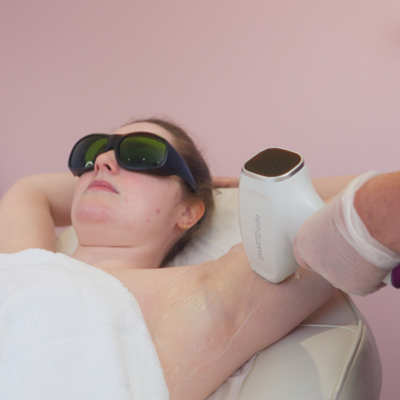 Course Offer - Laser Hair Removal Small Area (8 for 6)