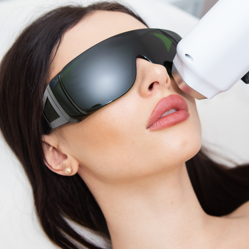 Upper Lip Laser Hair Removal