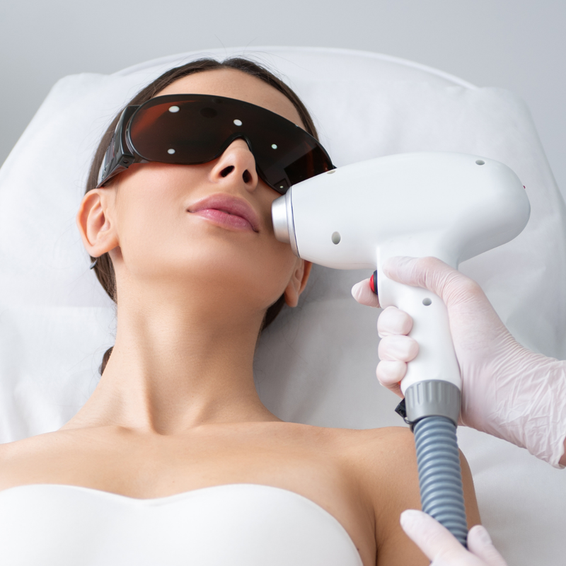 Upper Lip Laser Hair Removal