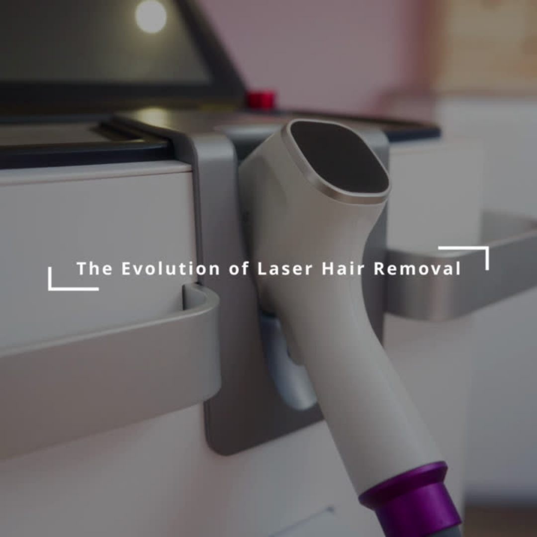 Laser Hair Removal - Small Area Offer | 6 sessions for the price of 5