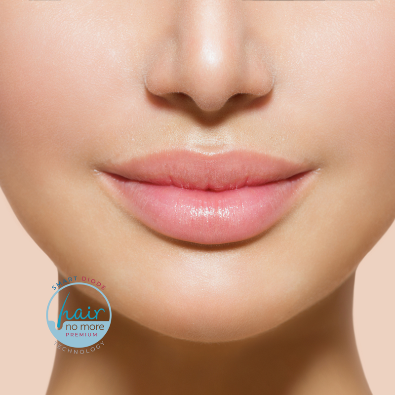 Upper Lip Laser Hair Removal