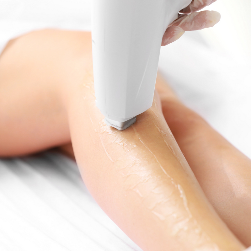 Course Offer - Laser Hair Removal Package 2 Medium Areas (8 for 6)